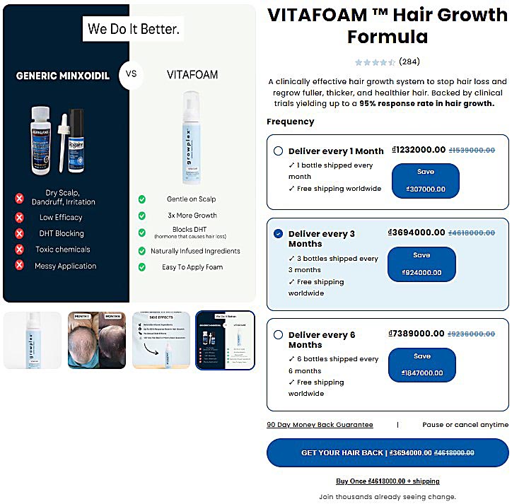 VitaFoam Hair Growth Formula – Hair Loss Treatment with Minoxidil 5%