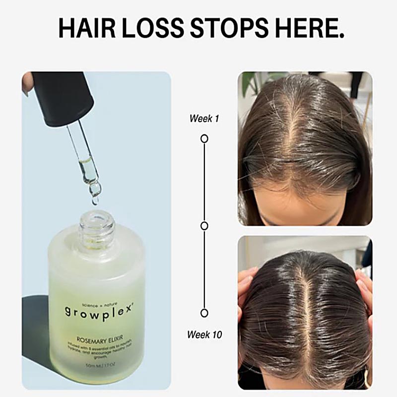Regrow Hair Naturally with Rosemary Elixir – 9 Oil Blend